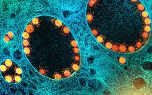 Terceira dose da AstraZeneca reforça anticorpos contra Ômicron