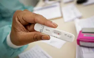 Casos de Covid têm queda de 90 % no Piauí diz Sesapi