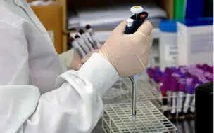 Fiocruz registra aumento de Casos de Síndrome Respiratória Aguda Grave