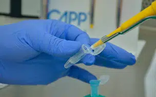 Brasil têm primeira morte pela variante Ômicron