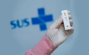 Testes rápidos do SUS permitem diagnósticos em até 30 minutos informa MS