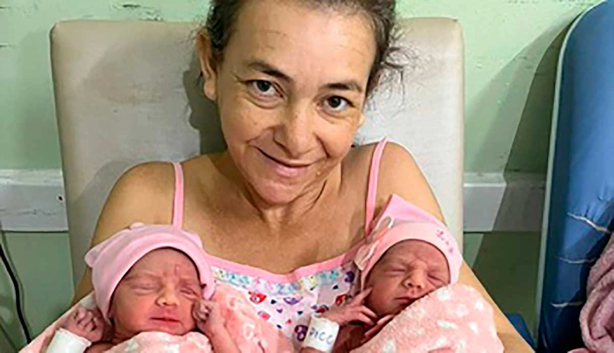 Mulher deu à luz gêmeas de uma gravidez raríssima